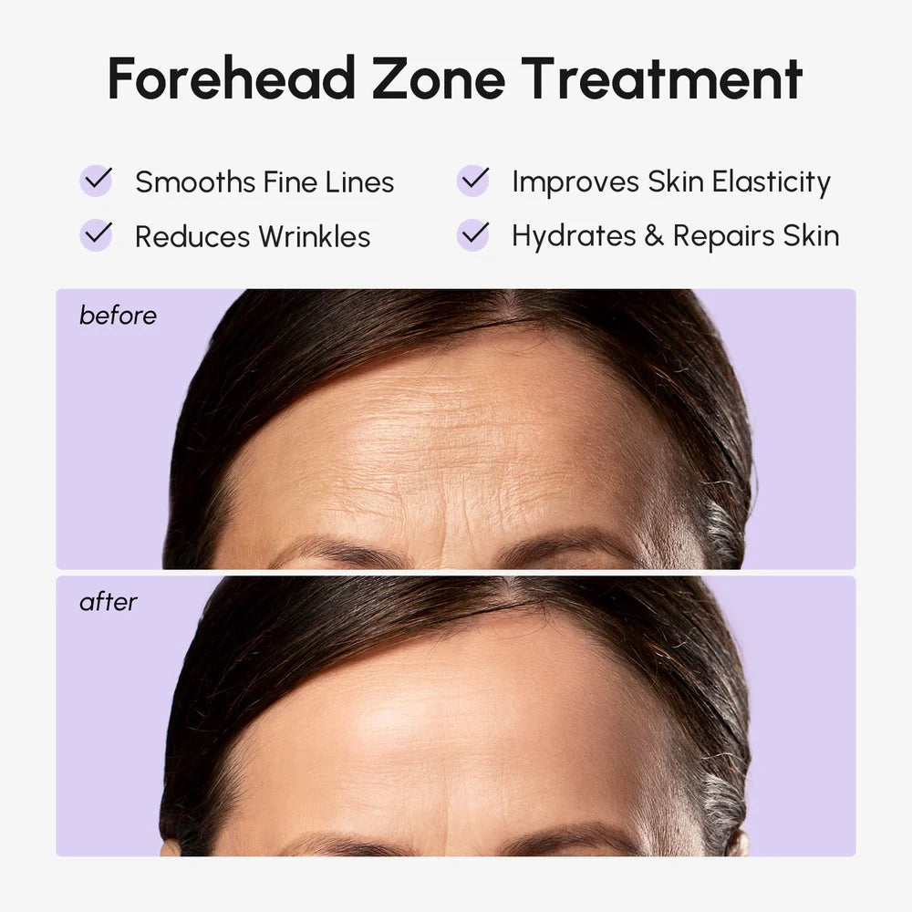 Collagen Forehead Patches – Skin Smoothing Treatment